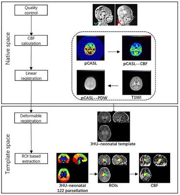 Regional impairment of deep gray matter perfusion in neonates with congenital heart disease revealed by arterial spin labeling MRI